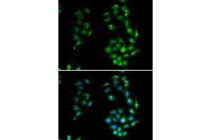 Immunofluorescence analysis of MCF7 cells using SOX5 antibody.