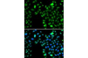 Immunofluorescence analysis of MCF-7 cells using ING5 antibody. (ING5 anticorps  (AA 1-220))