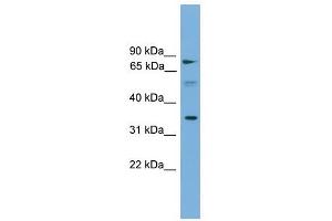 OSTalpha antibody used at 1 ug/ml to detect target protein.