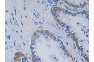 Detection of TNFSF9 in Human Prostate Tissue using Polyclonal Antibody to Tumor Necrosis Factor Ligand Superfamily, Member 9 (TNFSF9)