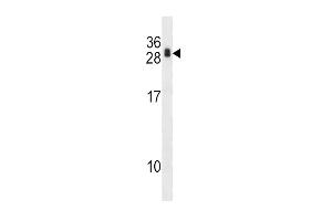 RCAN1 Antibody (N-term) (ABIN1539360 and ABIN2848483) western blot analysis in 293 cell line lysates (35 μg/lane). (RCAN1 anticorps  (N-Term))