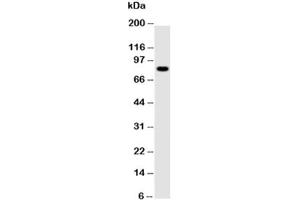 Western blot testing of NLRP4G antibody and mouse ovary tissue lysate (NLRP4G anticorps  (AA 704-721))