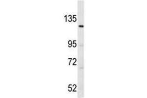 Western blot analysis of LATS1 antibody and K562 lysate.