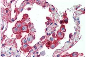 Human Lung (formalin-fixed, paraffin-embedded) stained with ALPL antibody ABIN462352 followed by biotinylated anti-mouse IgG secondary antibody ABIN481714, alkaline phosphatase-streptavidin and chromogen.