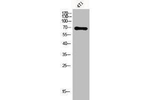 Western Blot analysis of 4T1 cells using Acetyl-Ku-70 (K331) Polyclonal Antibody