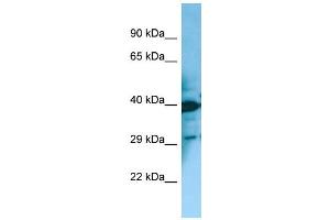 WB Suggested Anti-MCHR2 Antibody Titration: 1.