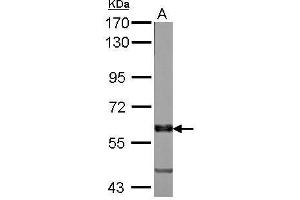 MPP6 anticorps  (N-Term)
