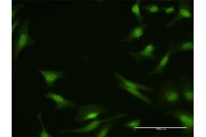 Immunofluorescence of purified MaxPab antibody to PPP2R4 on HeLa cell.