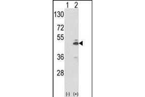 Western blot analysis of PKM2 (arrow) using rabbit polyclonal PKM2 Antibody (N-term ) (ABIN653018 and ABIN2842641). (PKM2 anticorps  (N-Term))