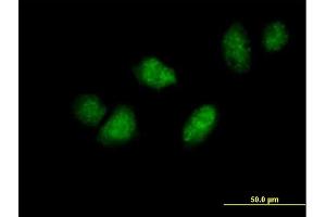 Immunofluorescence of purified MaxPab antibody to DDX3Y on HeLa cell.