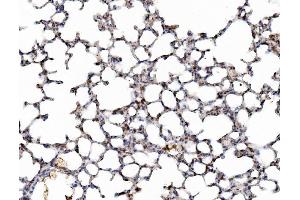 IHC analysis of Galectin 3/LGALS3 using anti-Galectin 3/LGALS3 antibody (ABIN3043400). (Galectin 3 anticorps  (AA 153-264))
