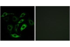 Immunofluorescence analysis of A549 cells, using PTGDR Antibody. (PTGDR anticorps  (AA 263-312))