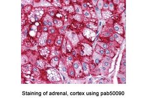 Image no. 4 for anti-Scavenger Receptor Class B, Member 1 (SCARB1) (AA 450-509), (C-Term) antibody (ABIN363399)