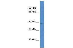 Western Blot showing AKR1D1 antibody used at a concentration of 1 ug/ml against RPMI-8226 Cell Lysate (AKR1D1 anticorps  (Middle Region))