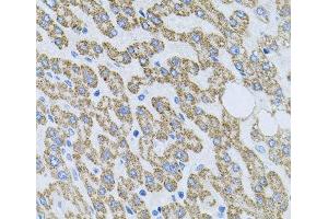 Immunohistochemistry of paraffin-embedded Human liver damage using NTF4 Polyclonal Antibody at dilution of 1:100 (40x lens). (Neurotrophin 4 anticorps)