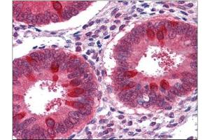 Human Uterus: Formalin-Fixed, Paraffin-Embedded (FFPE)