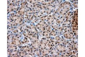 Immunohistochemistry (IHC) image for anti-Thiopurine S-Methyltransferase (TPMT) antibody (ABIN1501480)