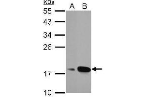 WB Image Sample (30 ug of whole cell lysate) A: A549 B: MCF-7 12% SDS PAGE antibody diluted at 1:1000 (AGR3 anticorps  (Center))