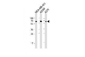 All lanes : Anti-CD63 Antibody (C-term) at 1:2000 dilution Lane 1: MDA-MB-453 whole cell lysate Lane 2:  whole cell lysate Lane 3:  whole cell lysate Lysates/proteins at 20 μg per lane.