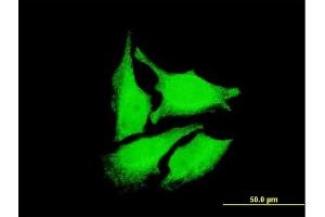 Immunofluorescence of monoclonal antibody to DEPDC1 on HeLa cell.