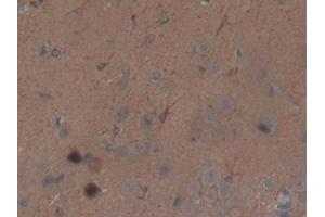 Detection of THBS1 in Rat Brain Tissue using Polyclonal Antibody to Thrombospondin 1 (THBS1)