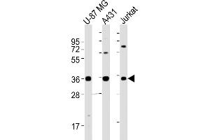 All lanes : Anti-MICA Antibody (Center) at 1:2000 dilution Lane 1: U-87 MG whole cell lysates Lane 2: A431 whole cell lysates Lane 3: Jurkat whole cell lysates Lysates/proteins at 20 μg per lane.
