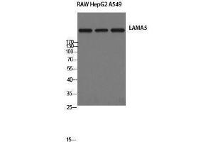 Western Blotting (WB) image for anti-Laminin, alpha 5 (LAMA5) (Internal Region) antibody (ABIN3185350) (Laminin alpha 5 anticorps  (Internal Region))