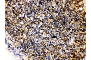 Anti- PLK1 Picoband antibody,IHC(P) IHC(P): Rat Lymphaden Tissue (PLK1 anticorps  (AA 86-430))