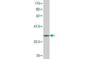 Western Blot detection against Immunogen (37. (STYK1 anticorps  (AA 50-159))