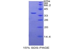 SDS-PAGE of Protein Standard from the Kit (Highly purified E. (PPL Kit ELISA)