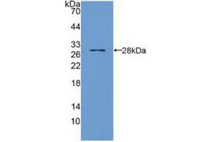 Western blot analysis of recombinant Human TIRAP. (TIRAP anticorps  (AA 1-221))