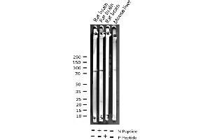 Western blot analysis of Phospho-PKC delta (Tyr313) expression in various lysates