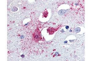 Anti-TAAR1 antibody IHC of human brain, amygdala.