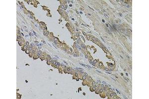 Immunohistochemistry of paraffin-embedded Human prostate using FMR1NB Polyclonal Antibody at dilution of 1:100 (40x lens).