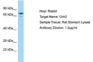 WB Suggested Anti-Grhl2 Antibody   Titration: 1.