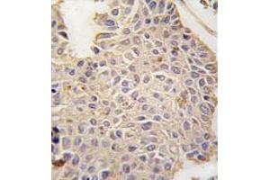 Image no. 3 for anti-Microtubule-Associated Protein 2 (MAP2) (C-Term) antibody (ABIN357399)