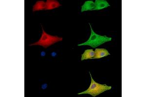ABIN7096909 and ABIN7100975 staining  cells by IF/ICC.