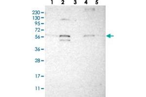 Western blot analysis of Lane 1: RT-4, Lane 2: U-251 MG, Lane 3: Human Plasma, Lane 4: Liver, Lane 5: Tonsil with C1orf27 polyclonal antibody  at 1:250-1:500 dilution. (ODR4 anticorps)