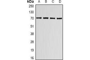 Western blot analysis of Lamin B Receptor expression in K562 (A), HT29 (B), mouse spleen (C), mouse lung (D) whole cell lysates. (Lamin B Receptor anticorps)