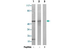 Western blot analysis of extracts from K-562 cells (Lane 1) and NIH/3T3 cells (Lane 2 and 3), using CAMK2A/CAMK2D polyclonal antibody . (CAMK2A anticorps)