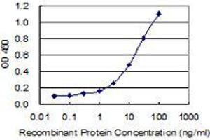 anti-Centlein, Centrosomal Protein (CNTLN) (AA 971-1070) antibody