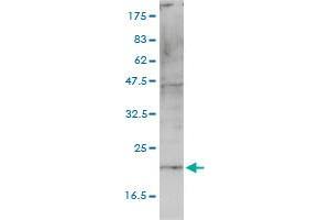 HSPC163 monoclonal antibody (M01), clone 4E10-1G4 Western Blot analysis of HSPC163 expression in A-431 . (CNIH4 anticorps  (AA 1-139))