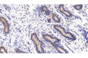 Detection of ATG16L1 in Human Uterus Tissue using Polyclonal Antibody to Autophagy Related Protein 16 Like Protein 1 (ATG16L1) (ATG16L1 anticorps  (AA 342-607))