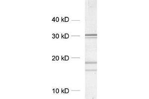 dilution: 1 : 5000, sample: crude synaptosomal fraction of rat brain (P2) (Clathrin anticorps  (AA 156-173))