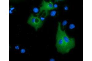 Anti-MTMR14 mouse monoclonal antibody (ABIN2453332) immunofluorescent staining of COS7 cells transiently transfected by pCMV6-ENTRY MTMR14 (RC207732). (MTMR14 anticorps)