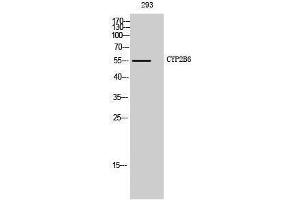 Western Blotting (WB) image for anti-Cytochrome P450, Family 2, Subfamily B, Polypeptide 6 (CYP2B6) (Internal Region) antibody (ABIN3184175)