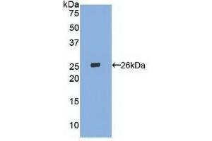 Detection of Recombinant LOX1, Human using Polyclonal Antibody to Lectin Like Oxidized Low Density Lipoprotein Receptor 1 (LOX1) (OLR1 anticorps  (AA 81-273))