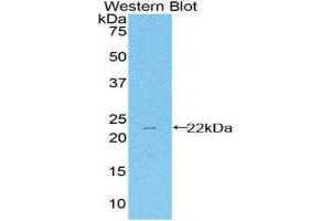 Western Blotting (WB) image for anti-Heat Shock 27kDa Protein 2 (HSPB2) (AA 12-170) antibody (ABIN1859222) (HSPB2 anticorps  (AA 12-170))