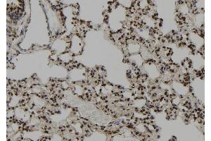 ABIN6273097 at 1/100 staining Rat lung tissue by IHC-P. (CEP164 anticorps  (C-Term))
