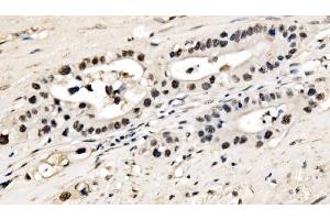 IHC analysis of CPSF6 using anti-CPSF6 antibody (ABIN7601898).